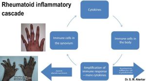 Rheumatoid inflammation